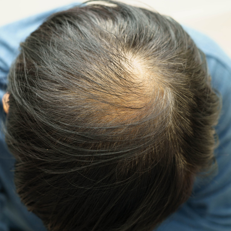 a close up of a person